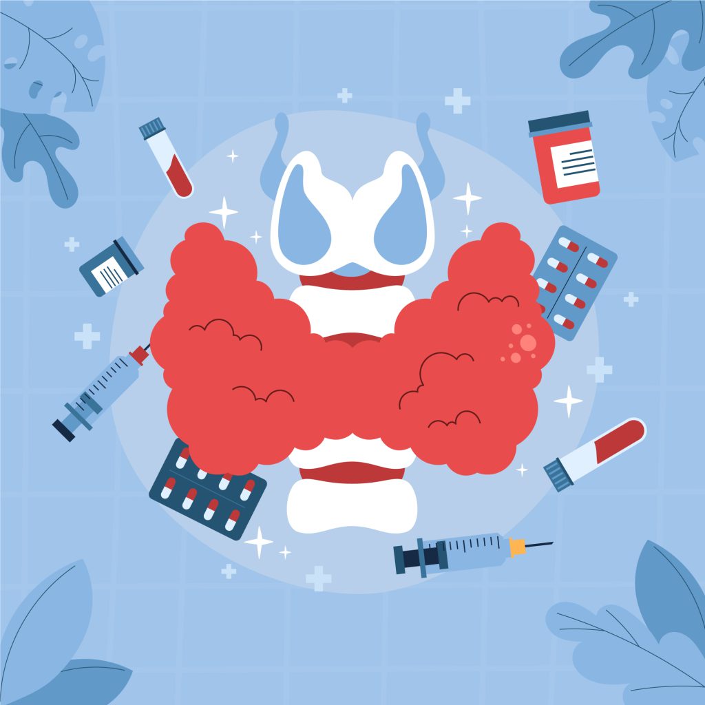 کم کاری تیروئید