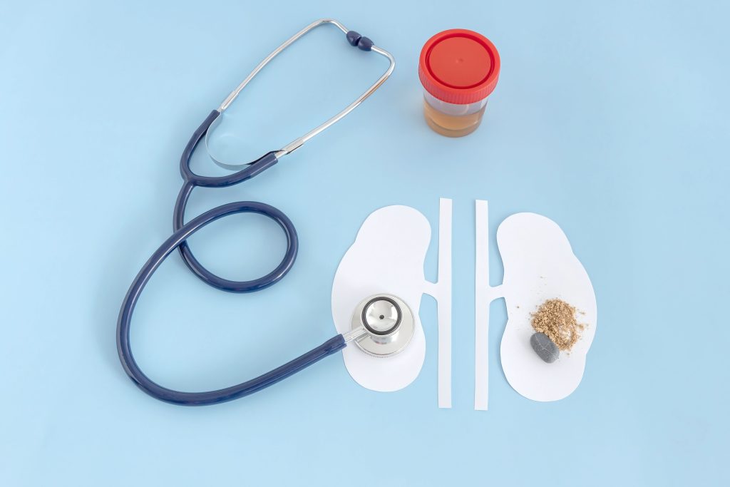 انجام دیالیز