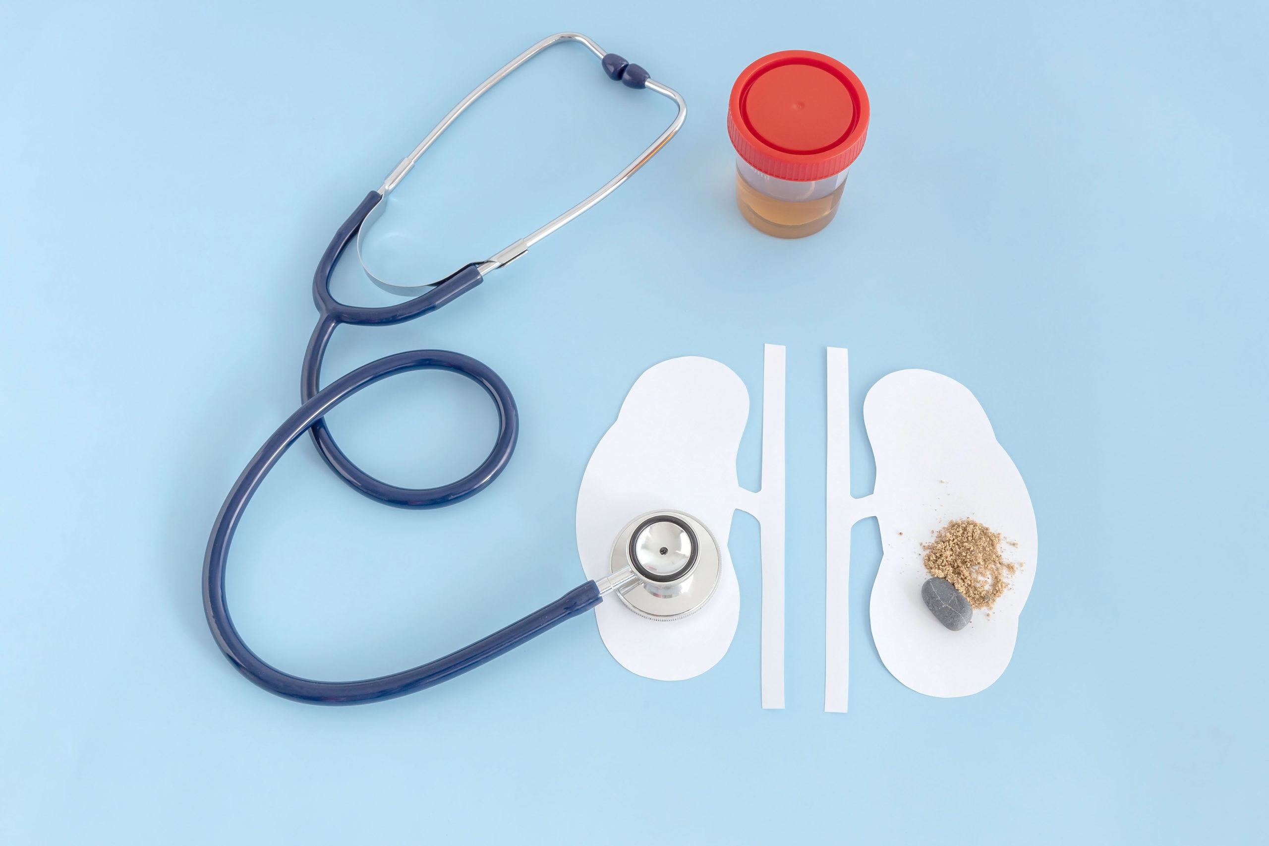 انجام دیالیز